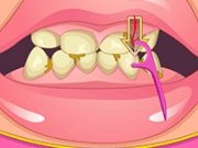 Albirea dintilor la dentist